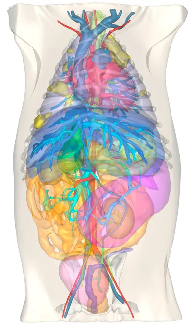 3D reconstruction image for the French bulldog lung tumor case